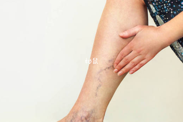孕期足部水肿可以缓解