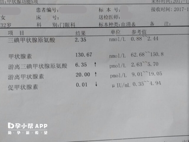 孕妇甲功必须检查游离甲状腺素FT4
