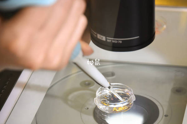 试管婴儿胚胎移植过程总共有五步