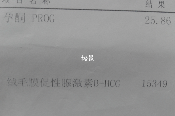 怀孕后HCG会不断上升