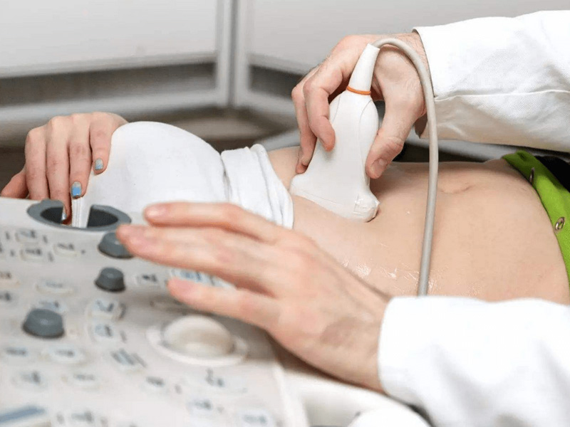 nt检查是通过彩超进行