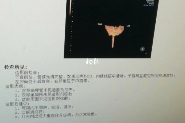 不孕不育需要做检查