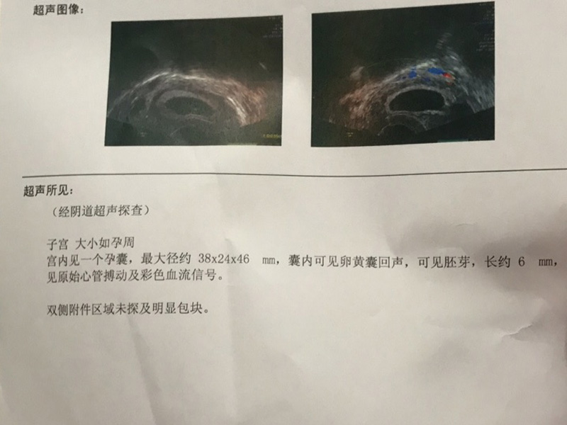 对此胎停的就需要查封闭抗体