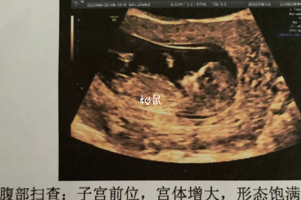 孕期挺着大肚子做B超也是可以的