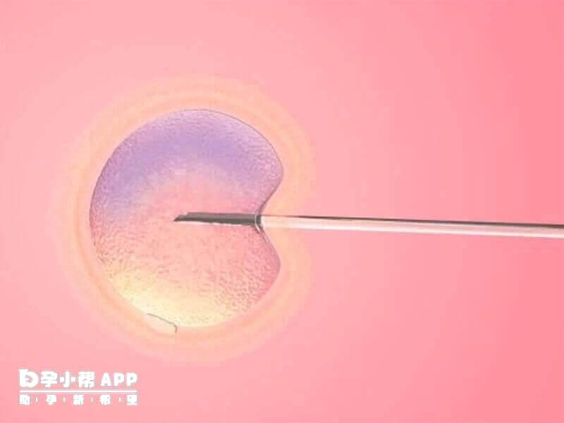 第三代试管婴儿PGD/PGS效果