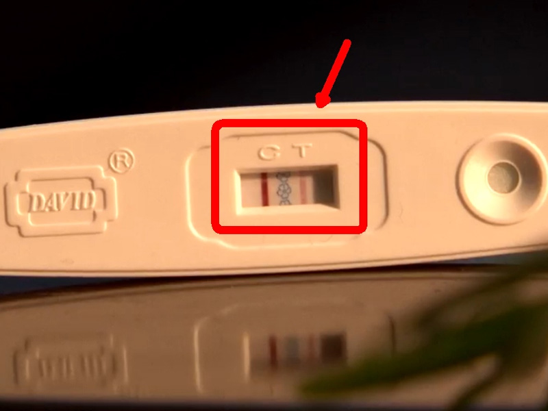 看面相无法知晓怀孕