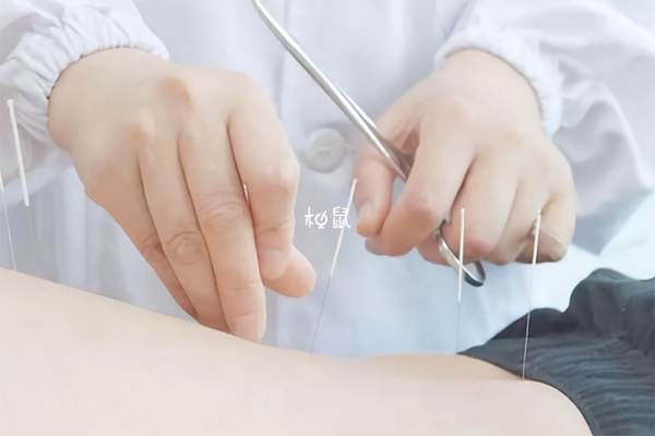 孕妇轻易不可进行针灸