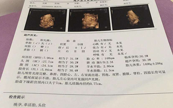 小排畸和普通彩超是一样的检查