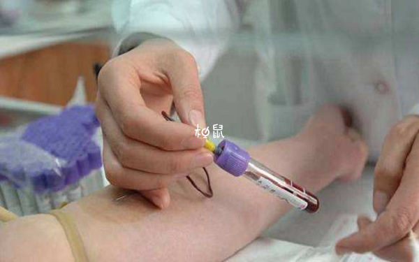 建档检查项目一上午能检查完