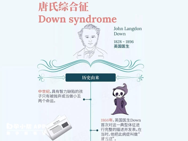 唐氏综合征的危害
