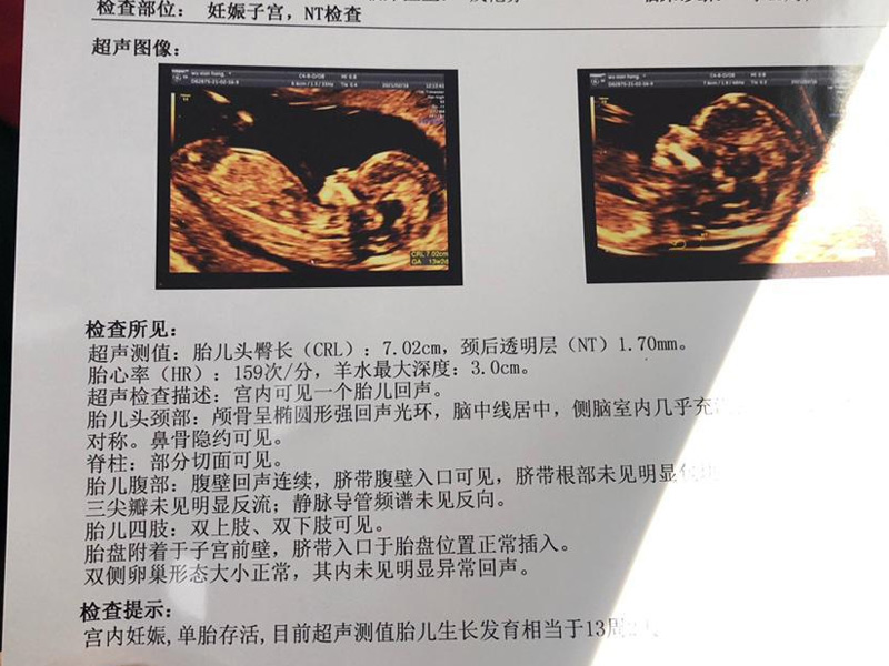 nt检查单不能看男女