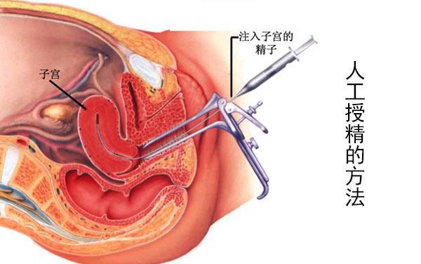 人工受精过程