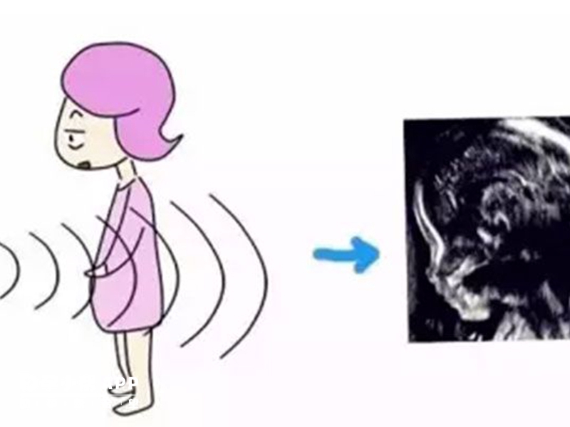 nt值偏高最坏的结果就是终止妊娠