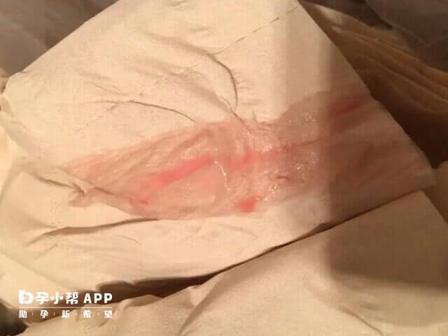 怀孕出血会影响女性身体健康