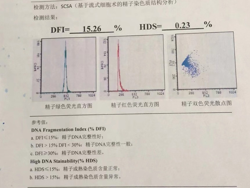 精子碎片检查可查出精子问题