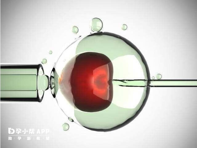 取卵手术大概10-15分钟
