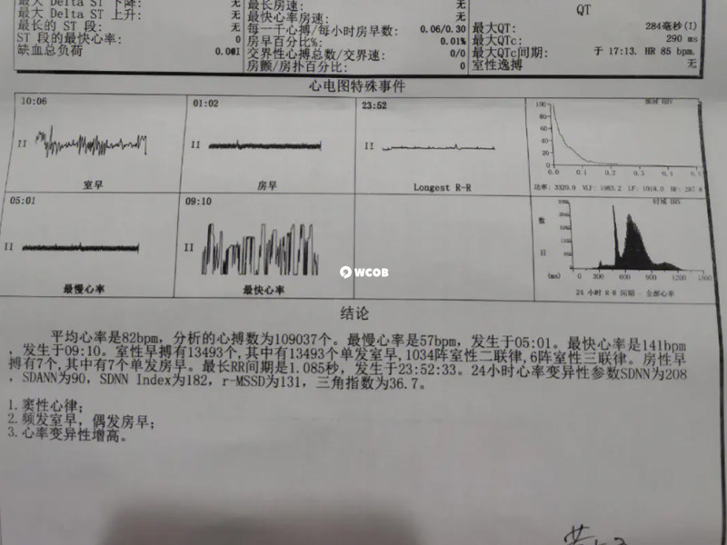 产检需要空腹