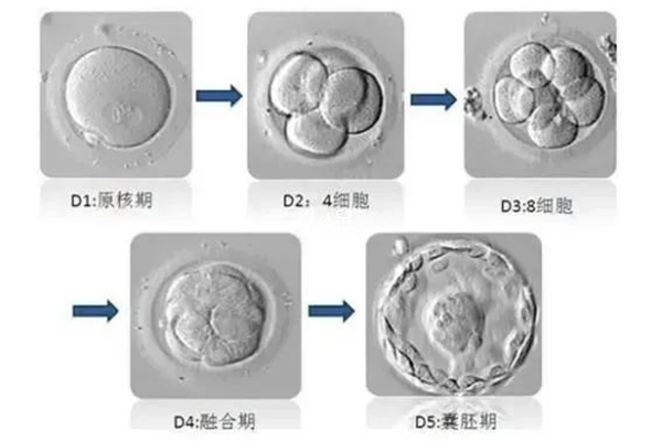 试管养囊全流程
