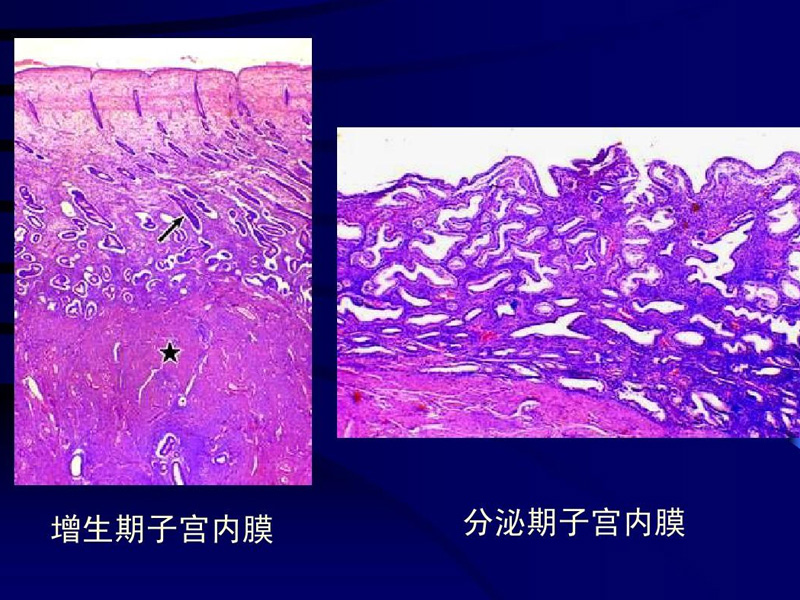 内膜4.5mm是不利于怀孕的