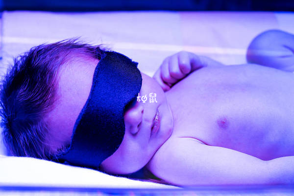 婴儿黄疸可能是妈妈引起的