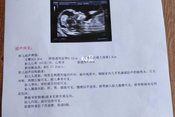 NT过不了会给高龄孕妇带来心理压力