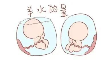 羊水的量示意图