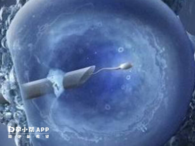 北京协和试管费包括术前检查